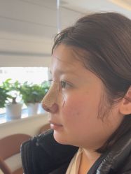 体验后-杭州美莱医疗美容医院