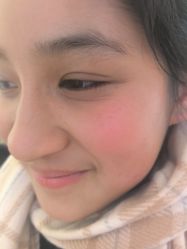 -长沙雅美医疗美容医院