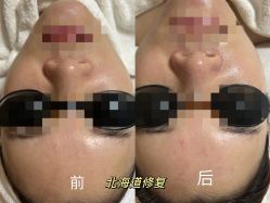 -LUNA皮相美·骨相美高级美感