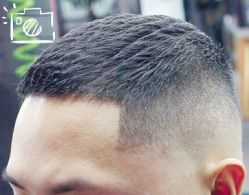 -大麦微针植发丨全国连锁