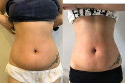 -产后帮产后修复(首城国际店)