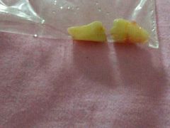 android_upload_pic-第四军医大学西京医院·体检二部