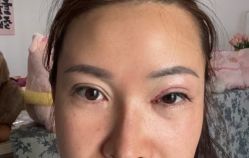 -广州美莱医疗美容医院