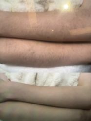 -杭州米兰柏羽医疗美容医院