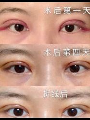 -深圳阳光医疗美容