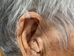 -惠耳听力助听器济南国际听力中心