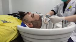 -大麦微针植发全国连锁