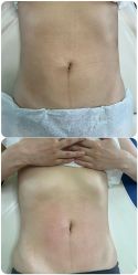 -后素孕产瑜伽·运动康复中心