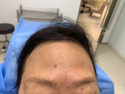 体验前-Yestar重庆艺星医疗美容医院