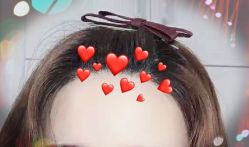 -大麦微针植发全国连锁