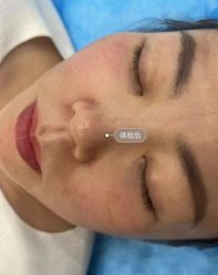 -天津健丽·去眼袋医疗美容机构