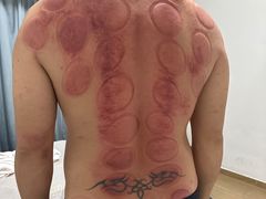 -感智盲人按摩·艾灸·肩颈SPA(岗厦店)