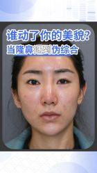-北京米扬丽格医疗美容·联合丽格鼻整形中心