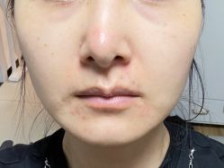 体验前-上海玫瑰医疗美容医院