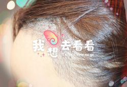 -大麦微针植发全国连锁