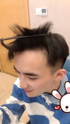 点击看大图 -大麦微针植发丨全国连锁