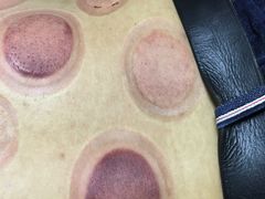 -沈师傅盲人按摩工作室(密三小区店)
