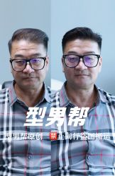 -型男帮男士假发补发·佩戴式发型