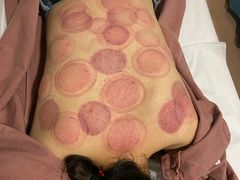 -金蚁康•经络调理•肩颈按摩(万达金街店)