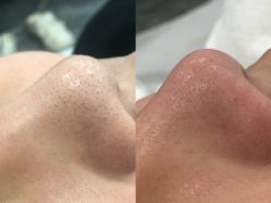 -苗方清颜专业祛痘·皮肤管理