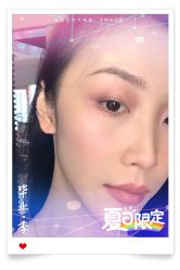 -大麦微针植发全国连锁