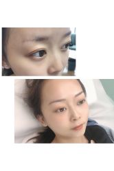 -久匠半永久纹眉