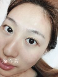 点击看大图 -西施无菌半永久纹绣眉眼影唇轻增发纹发际线