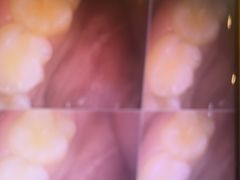 -土豆口腔(凤凰北总店)