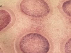 -郑远元专业修脚房·按摩·肉刺·灰指甲(苏绣路店)