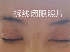 -苏州大学理想眼科医院