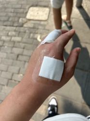 -一次性洗纹身·修复疤痕·超皮秒