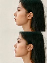 -素美医疗美容·西南眼鼻整形·修复基地