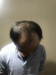 -极客侠男士假发定制补发