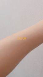体验后-禾美嘉医疗美容