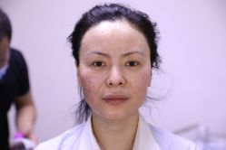 -北京叶子整形美容医院