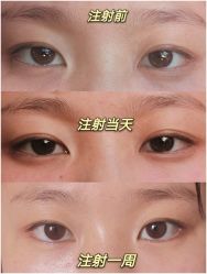 -洁铭新加坡医美