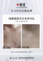 -痘庄科学祛痘国际连锁