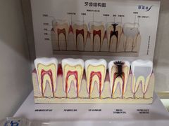 -上海仁爱医院口腔科 · 种植