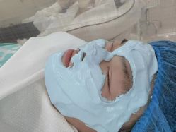 -悟空祛痘·诺奖技术专业店