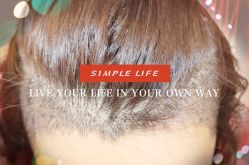 -大麦微针植发全国连锁