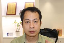 -大麦微针植发丨全国连锁