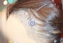 -大麦微针植发全国连锁