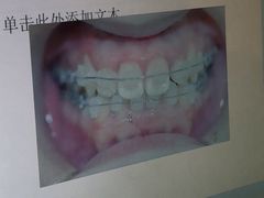 -柏乐口腔(南宁总院)
