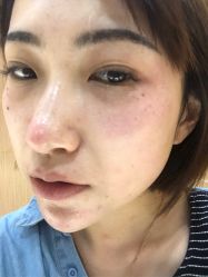 -上海玫瑰医疗美容医院