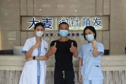 -大麦微针植发全国连锁