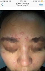 -YOUNGSKIN氧研皮肤管理中心