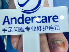 -Andrew指甲专科灰指甲·甲沟炎矫正·3D步态矫形鞋垫定制(浦三路店)