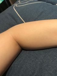 -咪咪专业脱毛连锁机构