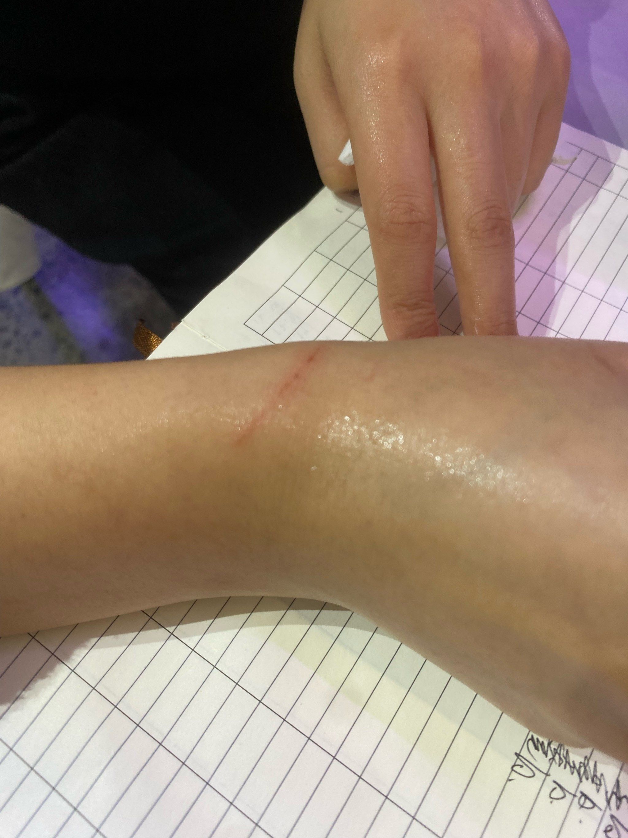 被猫咪抓伤了,来疗愈一下?