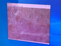 -悟空祛痘·诺奖技术专业店